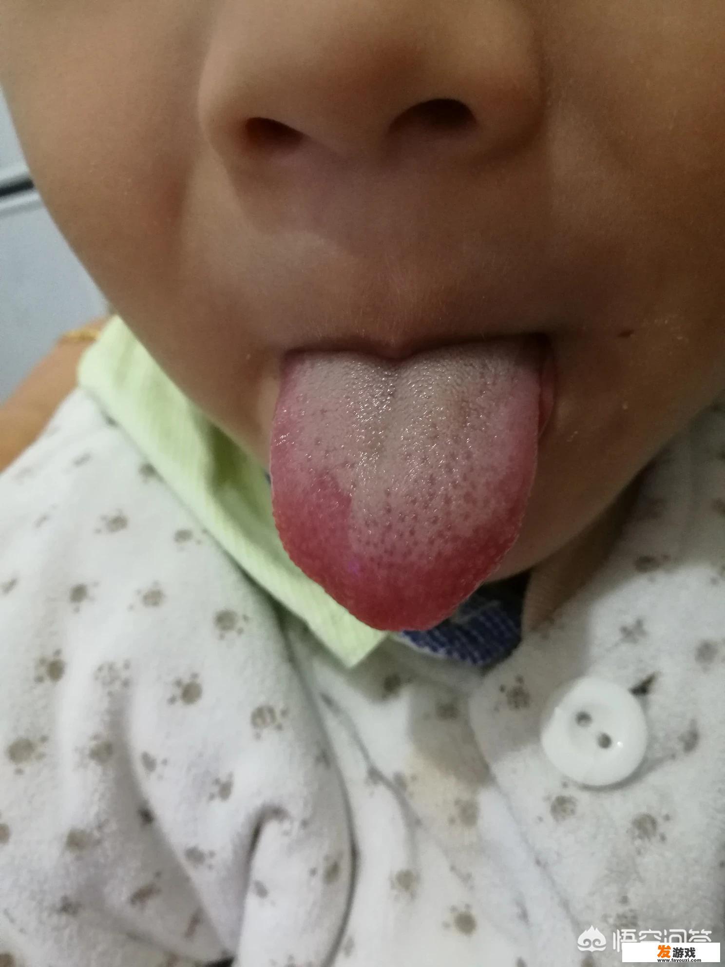 小儿为何经常出现积食，如何处理