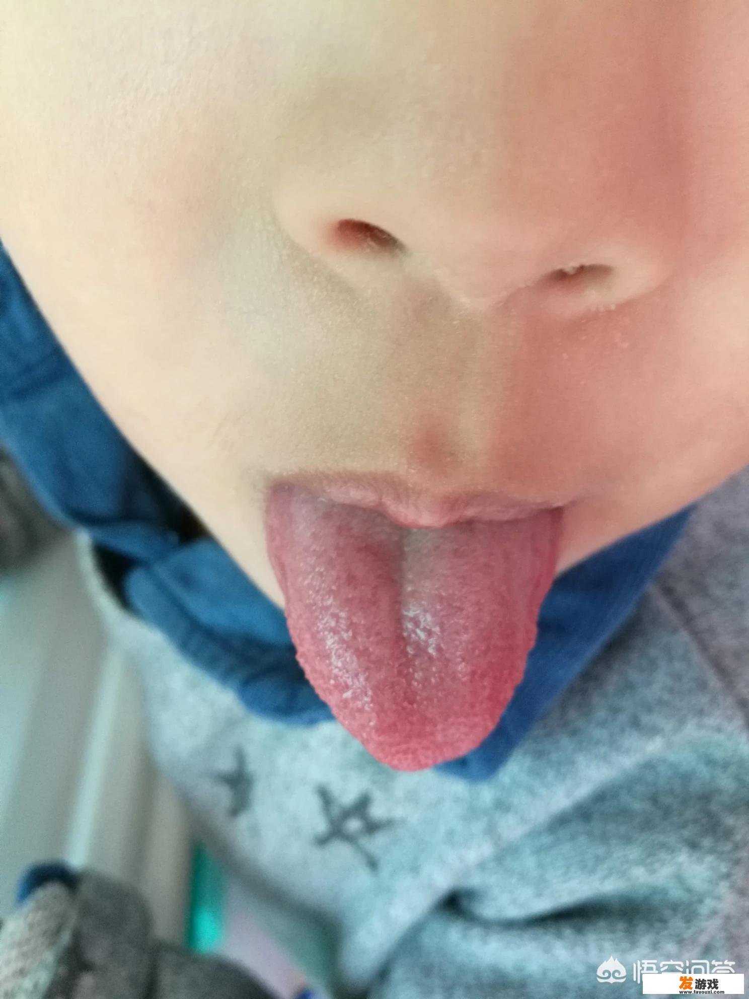 小儿为何经常出现积食，如何处理