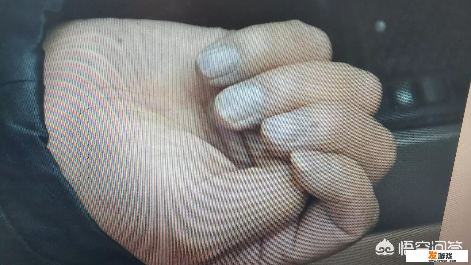 人死后脸色是青紫色是怎么回事