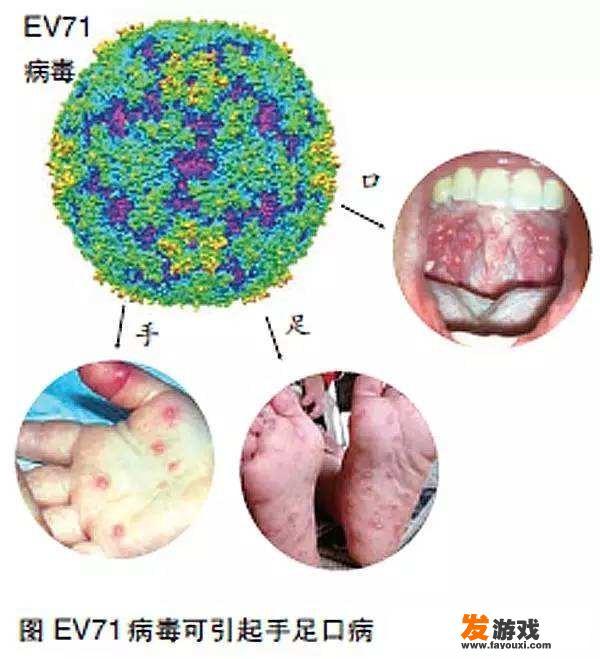 如何让宝宝远离手足口病？