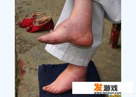 大家来谈一谈中国女人的缠足（裹小脚）的历史？